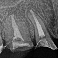 2013.03.21 2R07.jpg